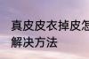 真皮皮衣掉皮怎么办 真皮皮衣掉皮的解决方法